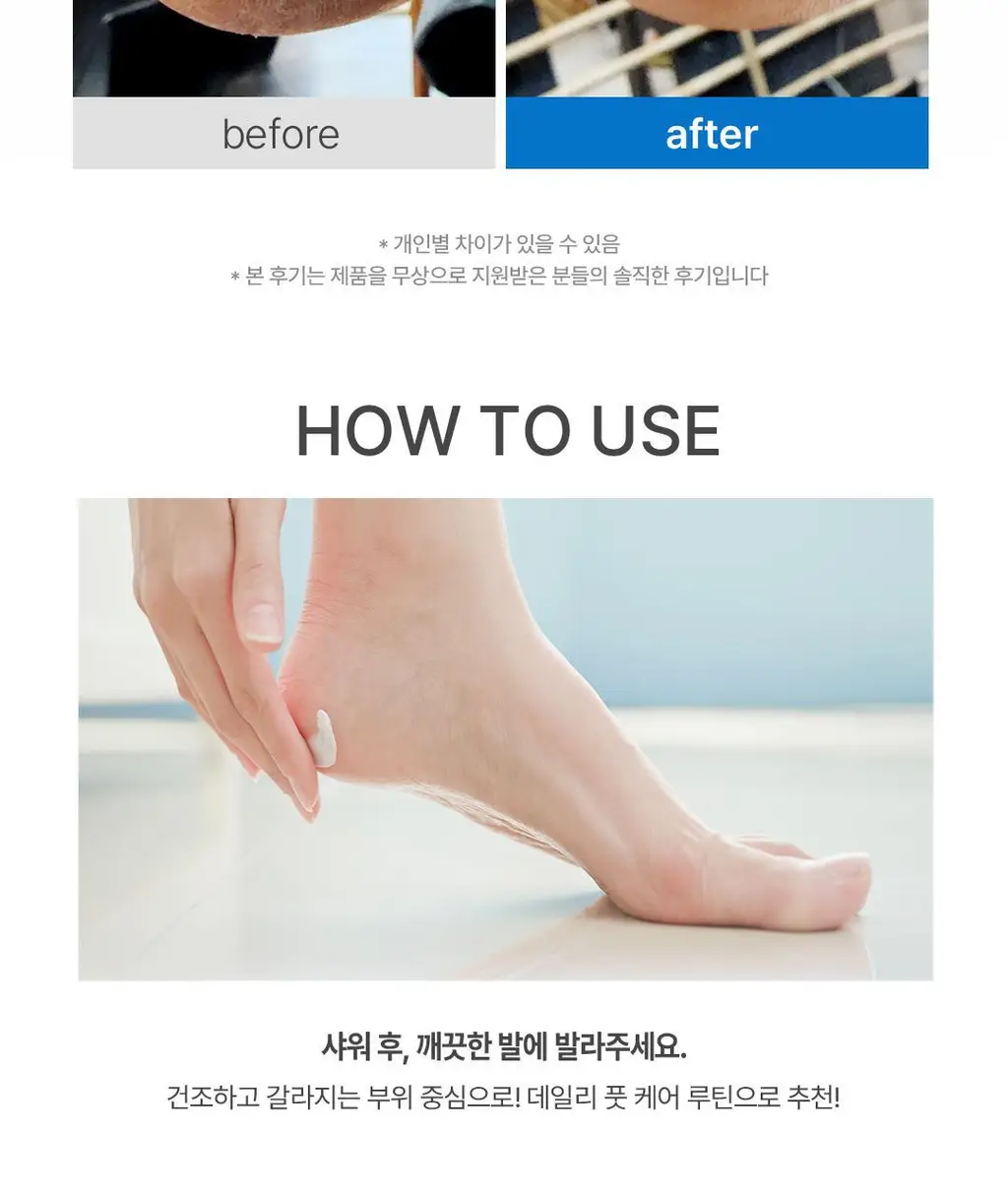 [NEW/페디케어] 반디 더마페디 3종 상세페이지 24